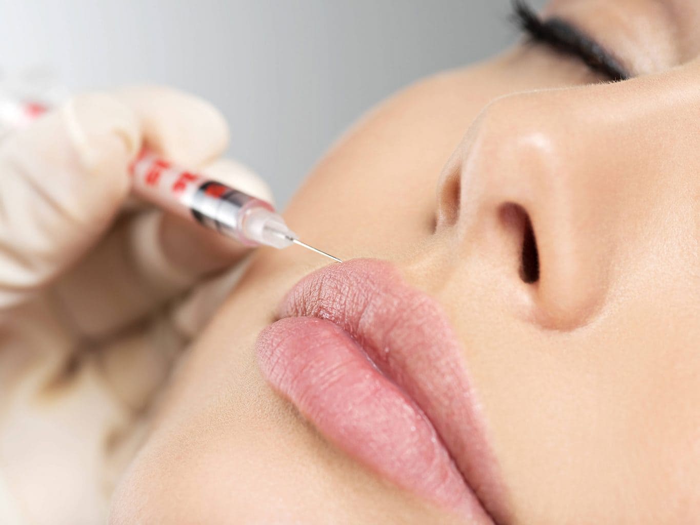 Fillers4-1365x1024_new