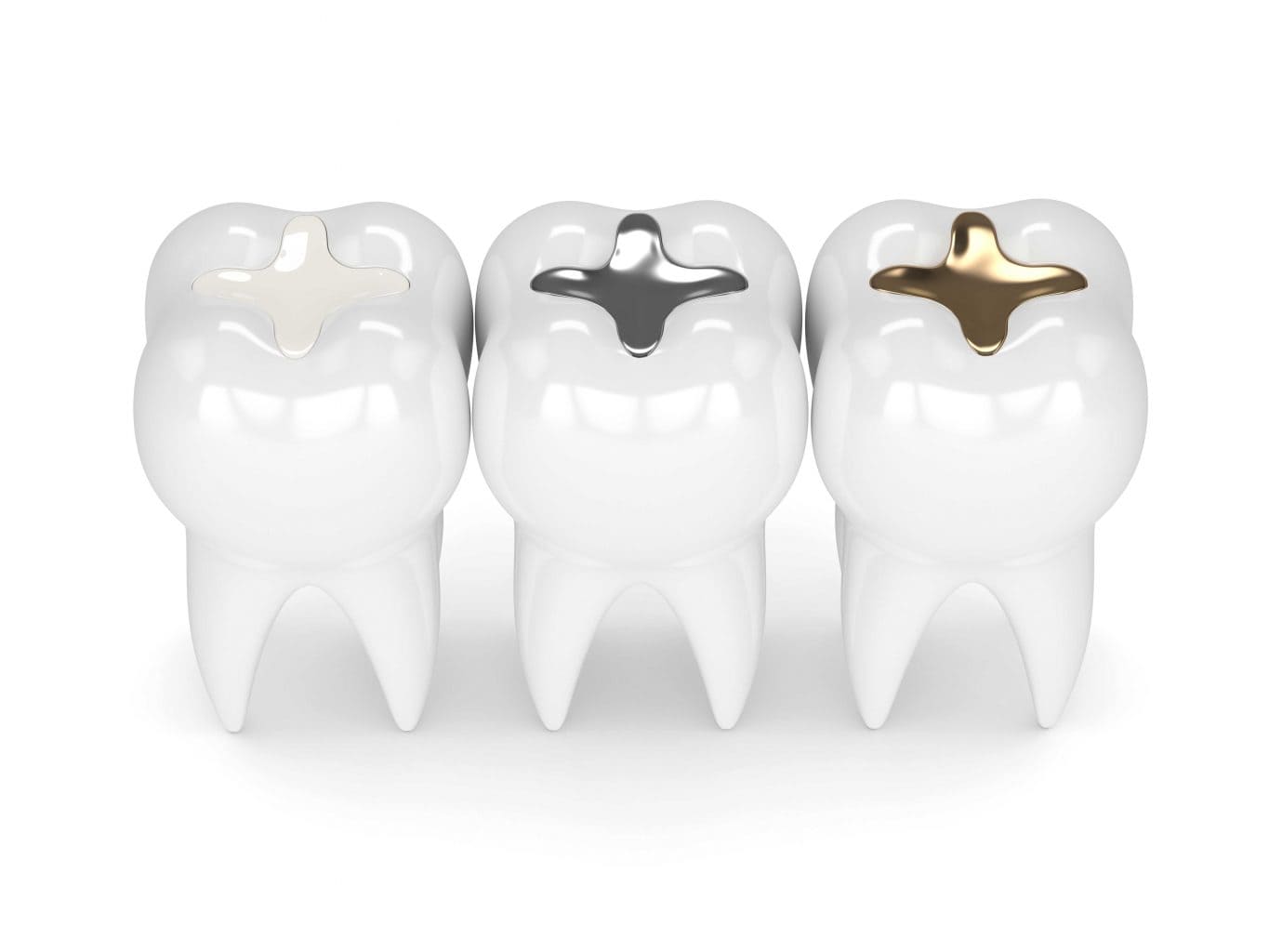 dental-filling-4-1365x1024_new