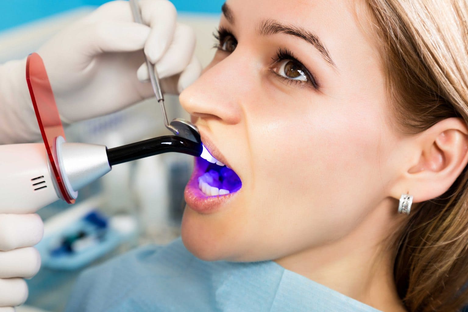 dental-filling-5-1536x1024_new